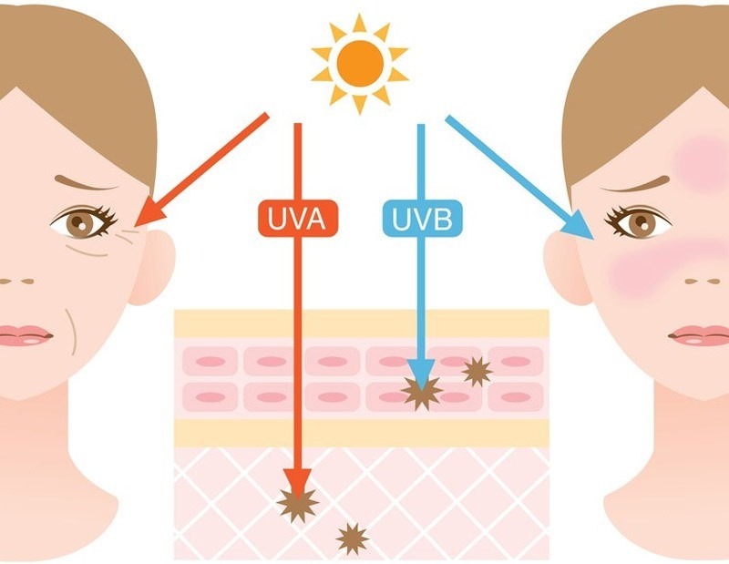 Top 3 sản phẩm trị nám của Nhật tốt trên thị trường 