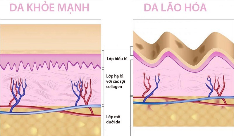 Bao nhiêu tuổi nên uống collagen để ngăn ngừa lão hóa? 