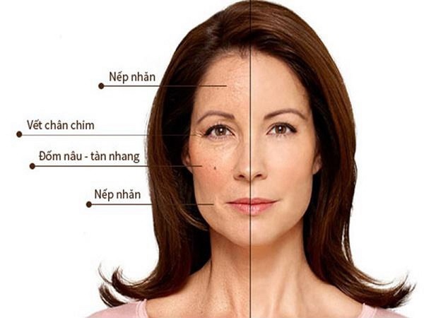 Bao nhiêu tuổi nên uống collagen để ngăn ngừa lão hóa? 