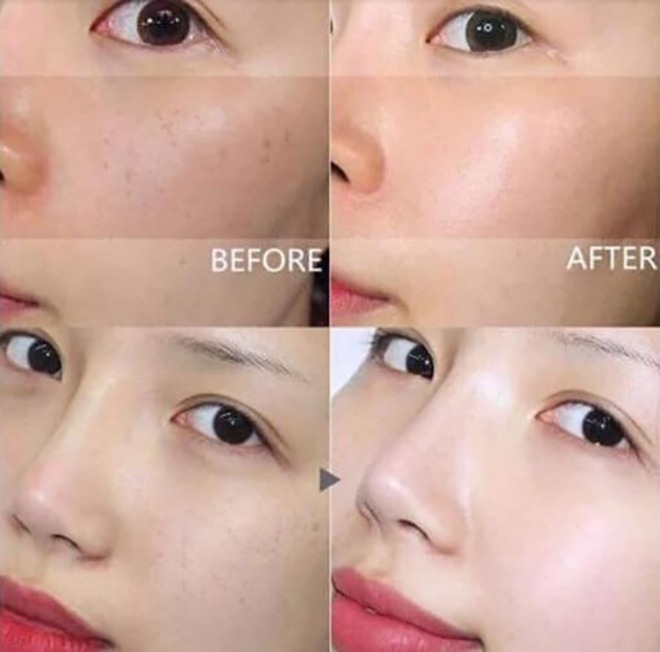 Tẩy tế bào chết có trắng da không? Sự thật cần biết ngay 